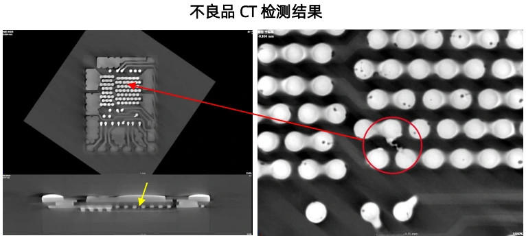 Published UR Hongxin case: CT localization of an internal flip-chip connection