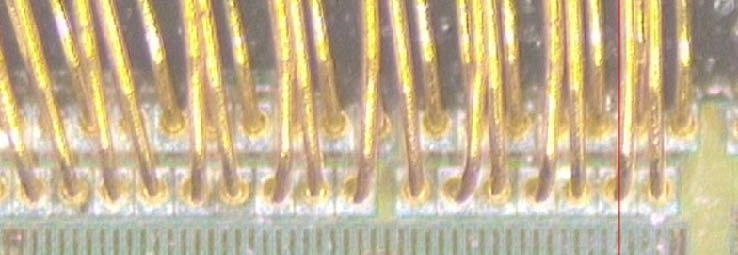 Case 01 · Bond-region detail for reviewing wire loops, connections and residue at different focal planes.